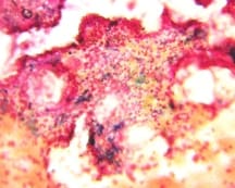 Iron Studies Interpretation: High and Low Parameters