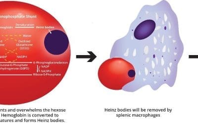 Glucose-6-phosphate dehydrogenase (G6PD) deficiency