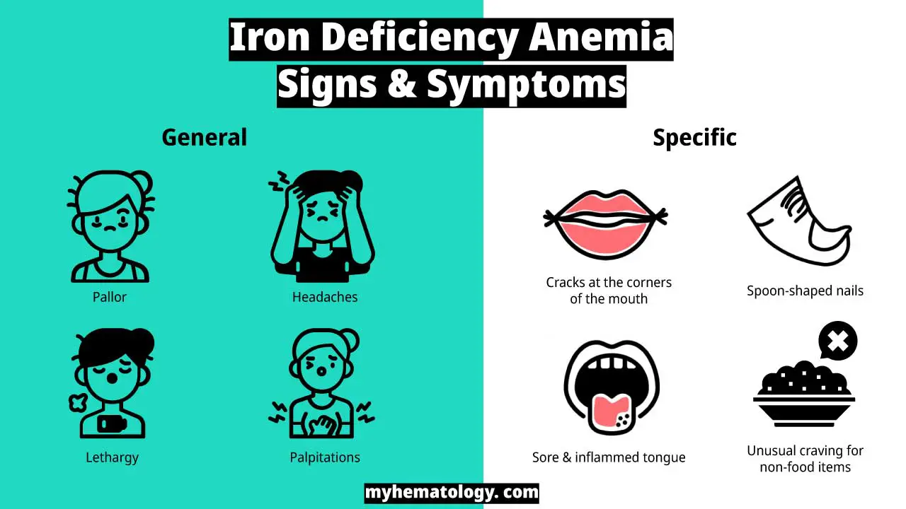 Signs and symptoms of iron deficiency anemia