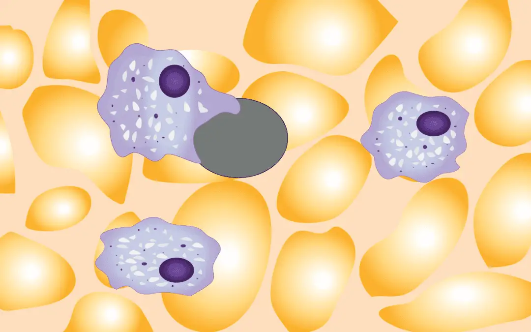 Immune Thrombocytopenia (ITP)