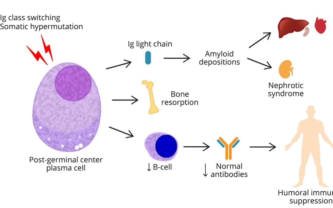 Multiple Myeloma