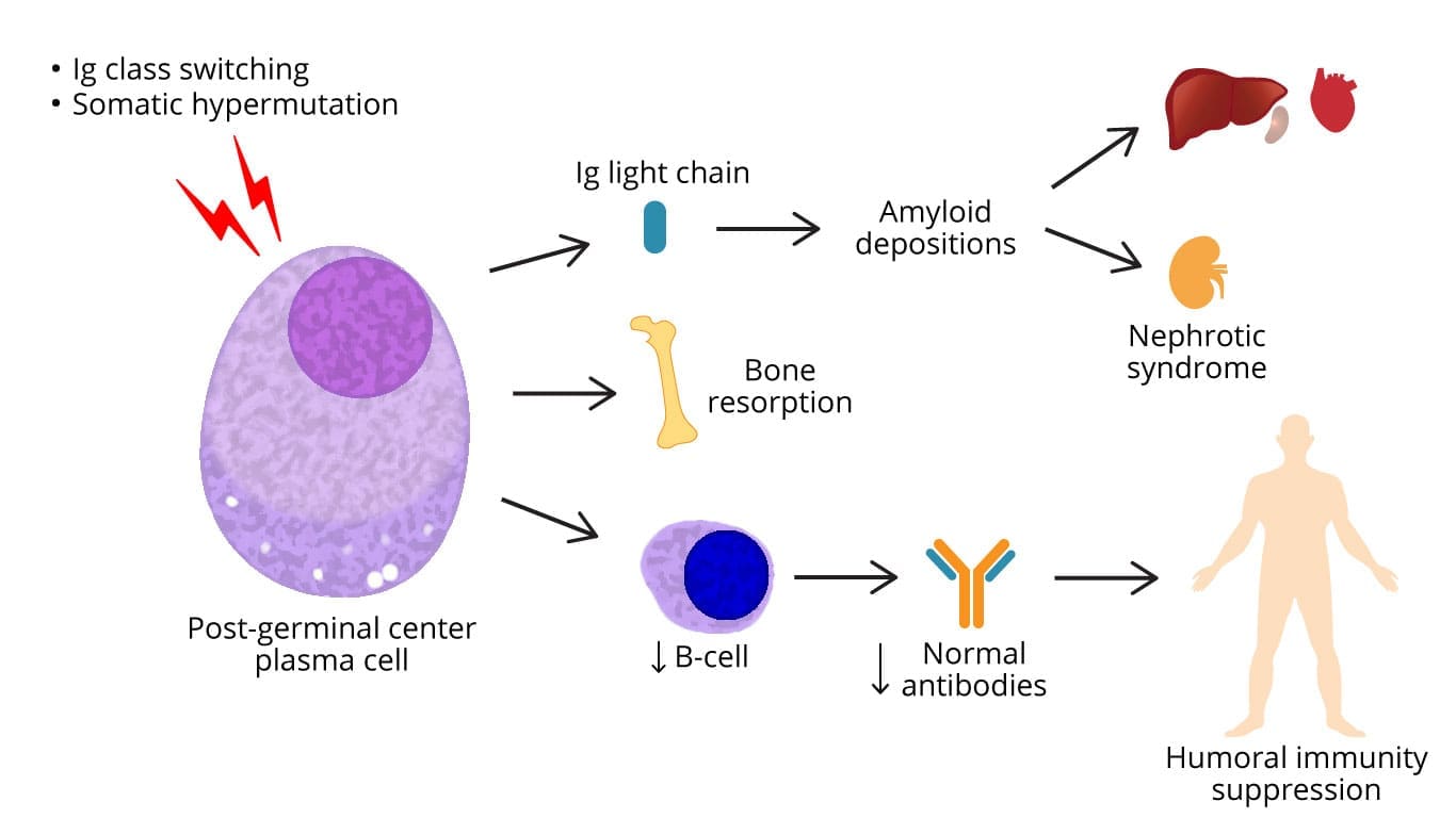 Image depicting a microscopic view of multiple myeloma cells, highlighting their uncontrolled proliferation, bone lesions, and disruption of the immune system