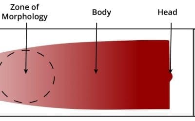 Preparation of Peripheral Blood Smears