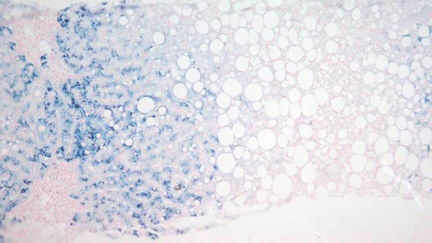Perls Staining Perls’ / Prussian Blue Staining for Iron Stores Protocol