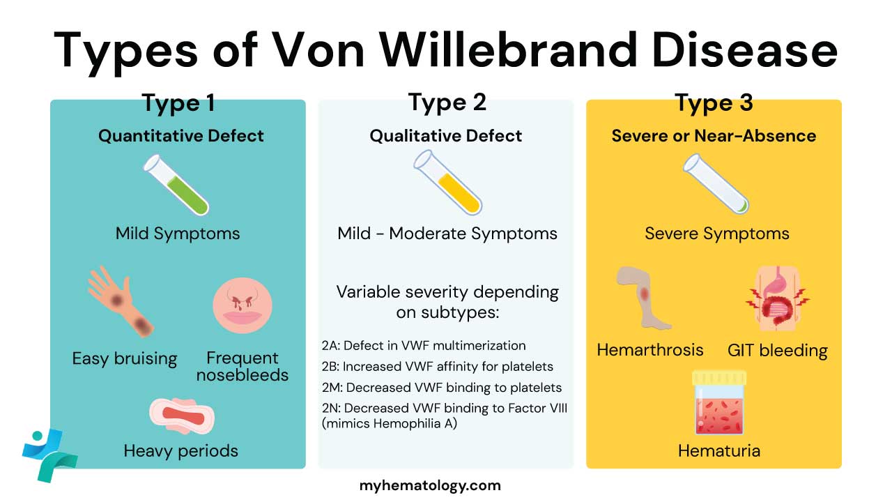 The types of Von Willebrand Disease (VWD) are classified based on whether the von Willebrand factor (VWF) is deficient in quantity or defective in quality. Type 1 is the most common form (60–80%), characterized by a partial quantitative deficiency of functionally normal VWF, leading to typically mild symptoms. Type 2 (15–30%) is a qualitative defect where the VWF protein is present in normal or near-normal amounts but does not function correctly; this type is further divided into four subtypes ($2A, 2B, 2M, 2N$) with variable and generally moderate symptoms. Finally, Type 3 is the rarest and most severe form (5–10%), resulting from a near-complete or total absence of VWF, which also causes a marked secondary deficiency of clotting Factor VIII and can lead to severe bleeding, including joint and muscle bleeds.