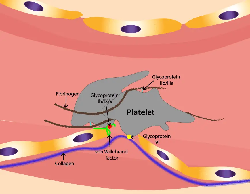 von Willebrand Disorder (vWD)