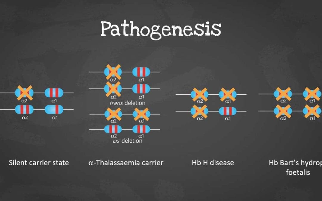 Alpha Thalassemia