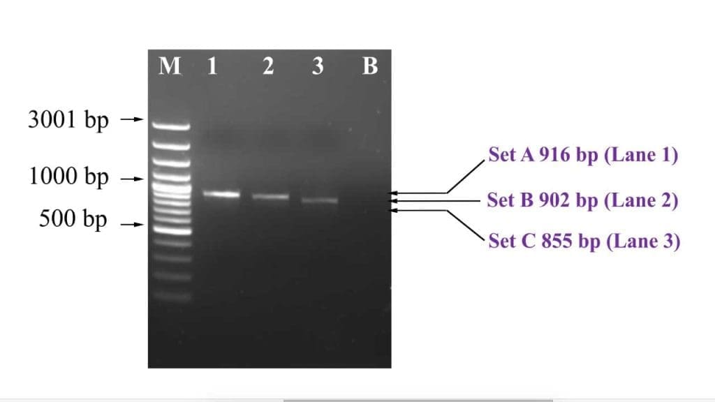 This image showcases the distinct bands representing successful amplification of beta-globin gene with agarose gel electrophoresis for downstream sequencing protocol.