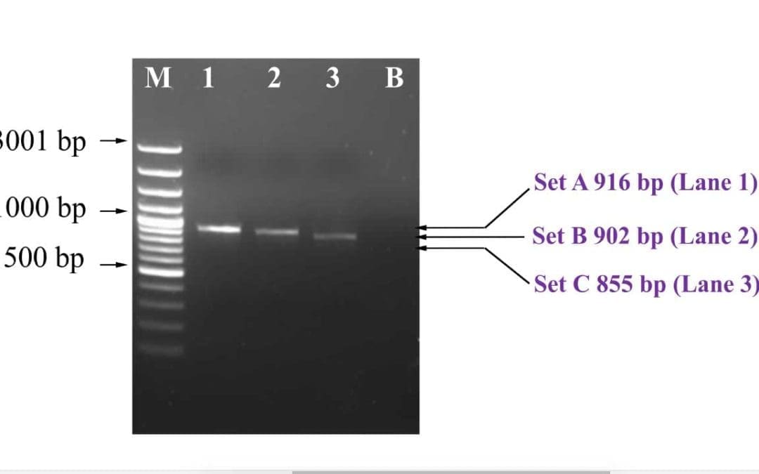Agarose Gel Electrophoresis Preparation for PCR