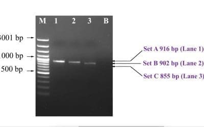 Agarose Gel Electrophoresis Preparation for PCR