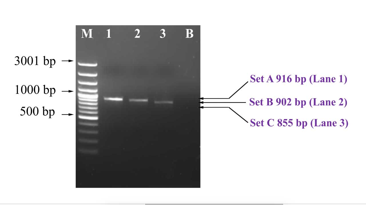 This image showcases the distinct bands representing successful amplification of beta-globin gene for downstream sequencing protocol. 