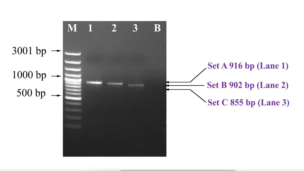 This image showcases the distinct bands representing successful amplification of beta-globin gene for downstream sequencing protocol.