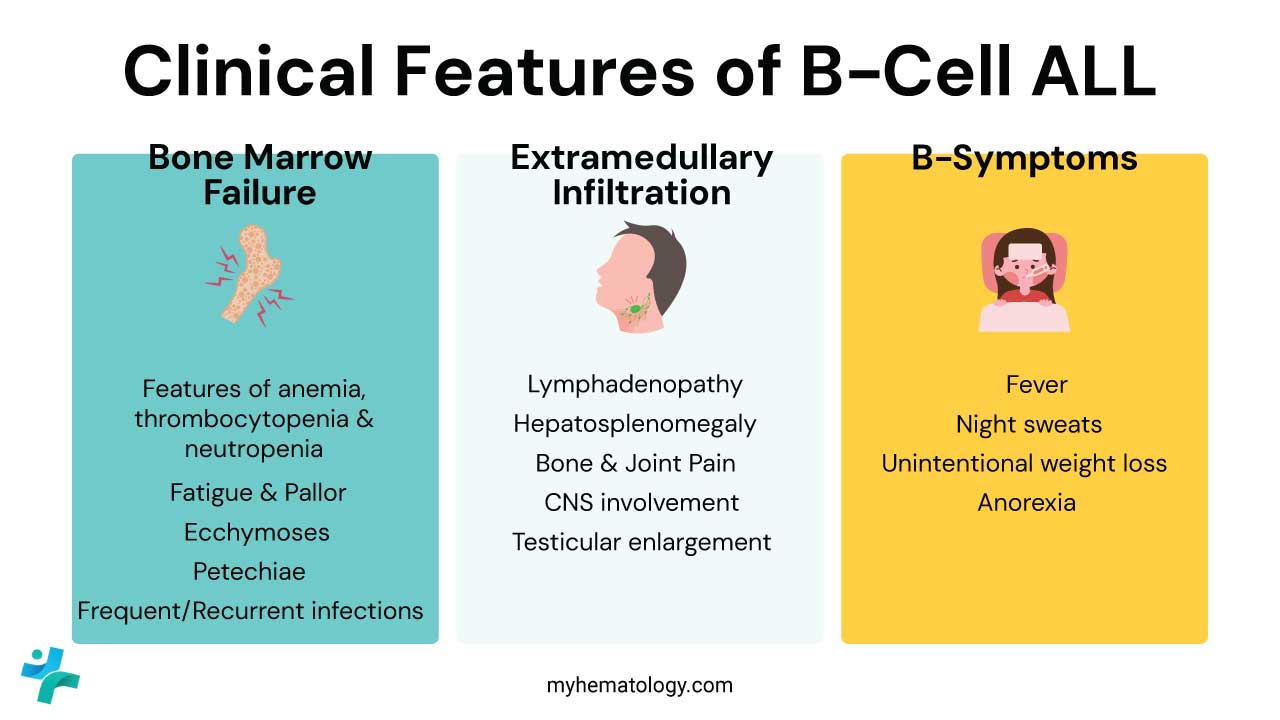 Clinical features of B-cell ALL includes features of bone marrow failure, extramedullary infiltration and B symptoms