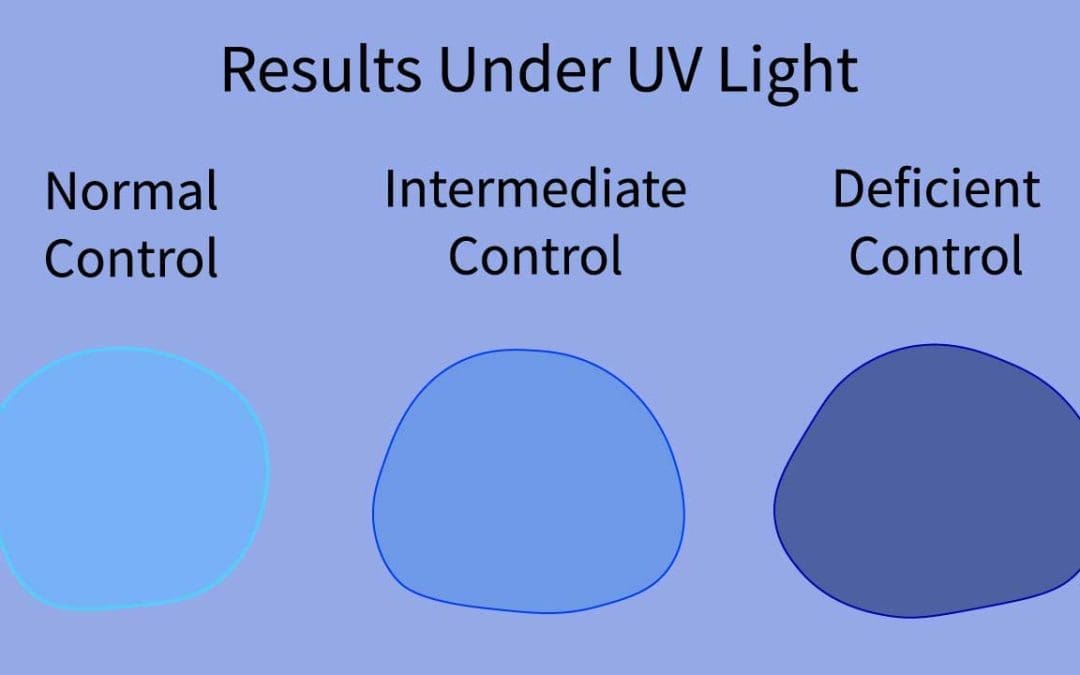 Glucose-6-Phosphate Dehydrogenase (G6PD) Fluorescent Spot Test