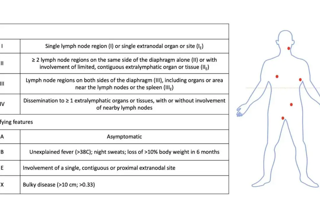 Classic Hodgkin Lymphoma Treatment Strategies