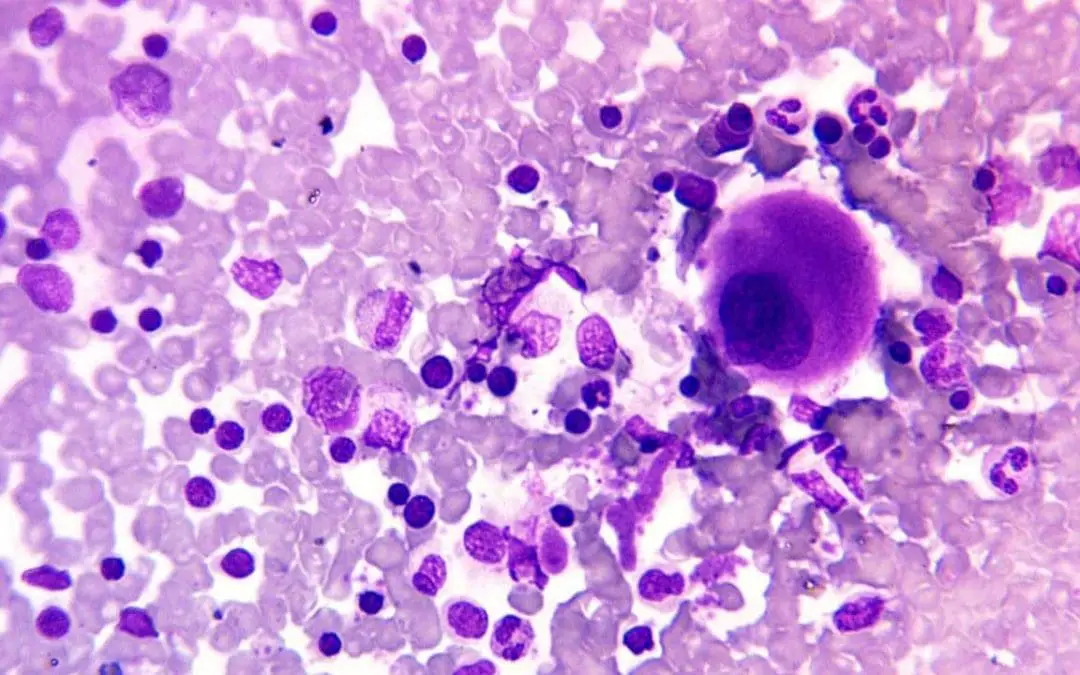 May Grunwald Giemsa (MGG) Staining