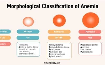 Anemia: Types, Symptoms & Treatment