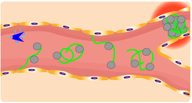 Thrombotic thrombocytopenic purpura (TTP)