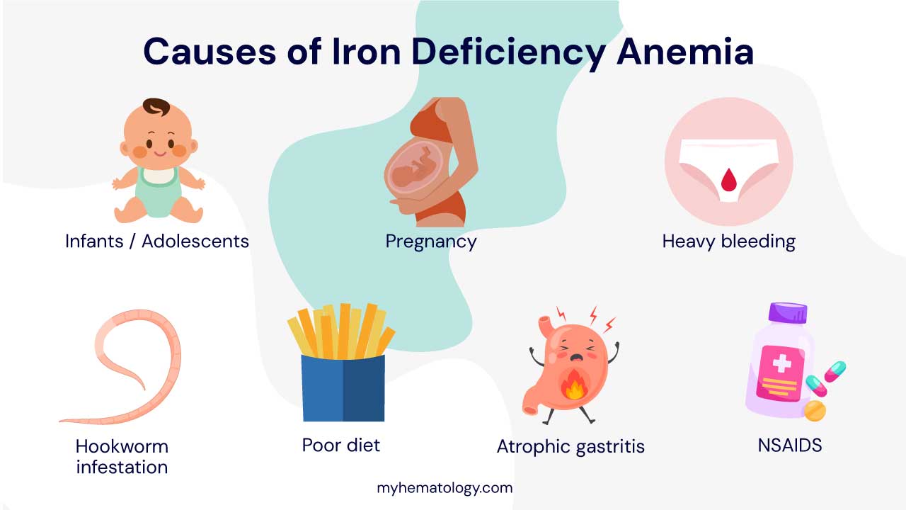 Infographic on the common causes of iron deficiency anemia including infants / adolescents, pregnancy due to increased iron demand, chronic blood loss like heavy bleeding, hookworm infestation and atrophic gastritis, poor diet and certain medications like NSAIDs