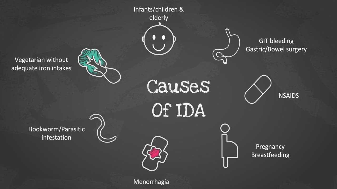 Delve into the realm of iron deficiency anemia and uncover its primary causes including inadequate dietary intake, impaired absorption, and chronic blood loss. This insightful image reveals the key factors contributing to this prevalent form of anemia.