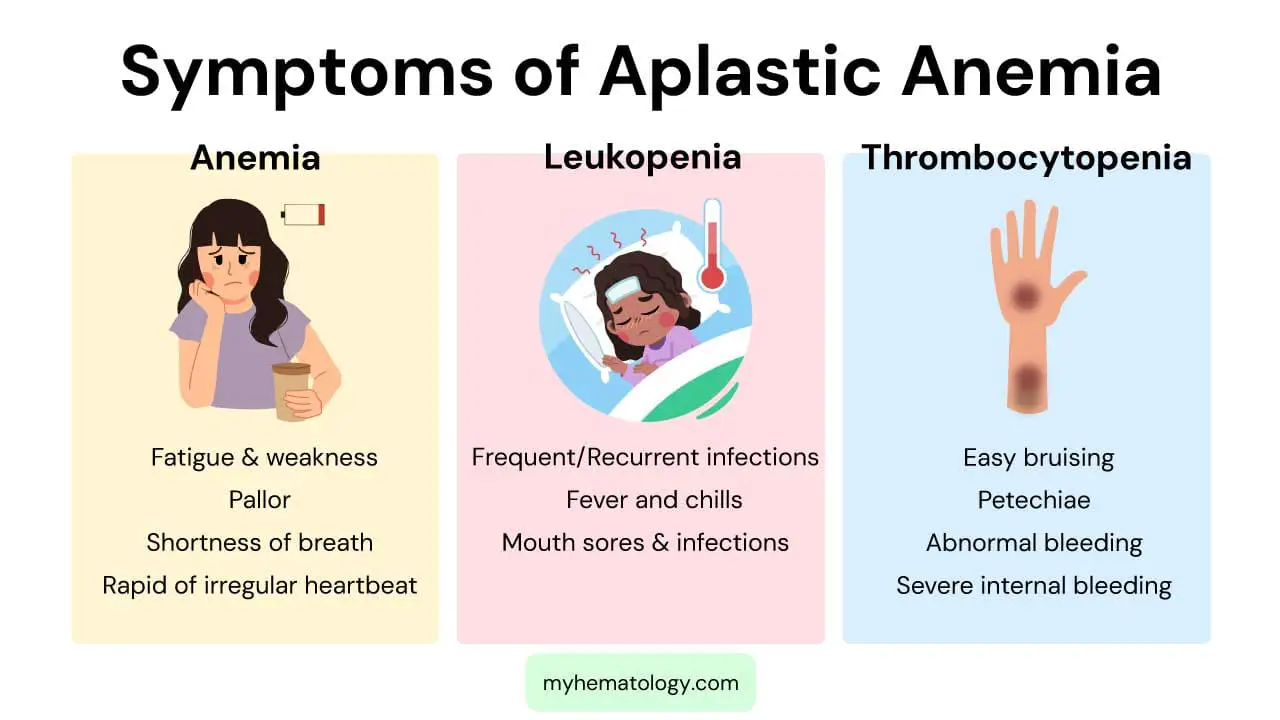 Symptoms of aplastic anemia include symptoms of anemia, leukopenia and thrombocytopenia