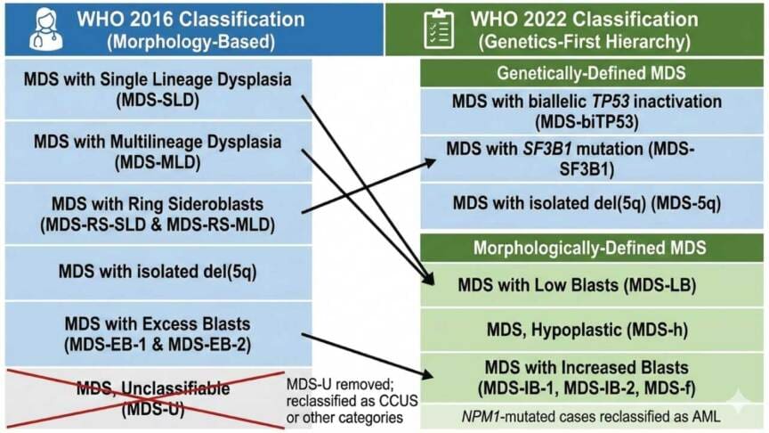 Mds Sign Myelodysplastic Syndrome or MDS: Types, Symptoms & Diagnosis