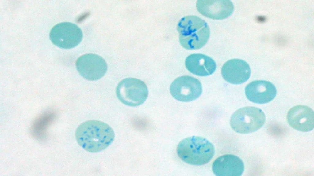 Reticulocytes can be visualized using the BCB stain