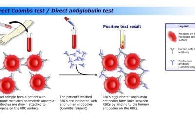 Direct Antiglobulin (Coombs) Test (DAT)