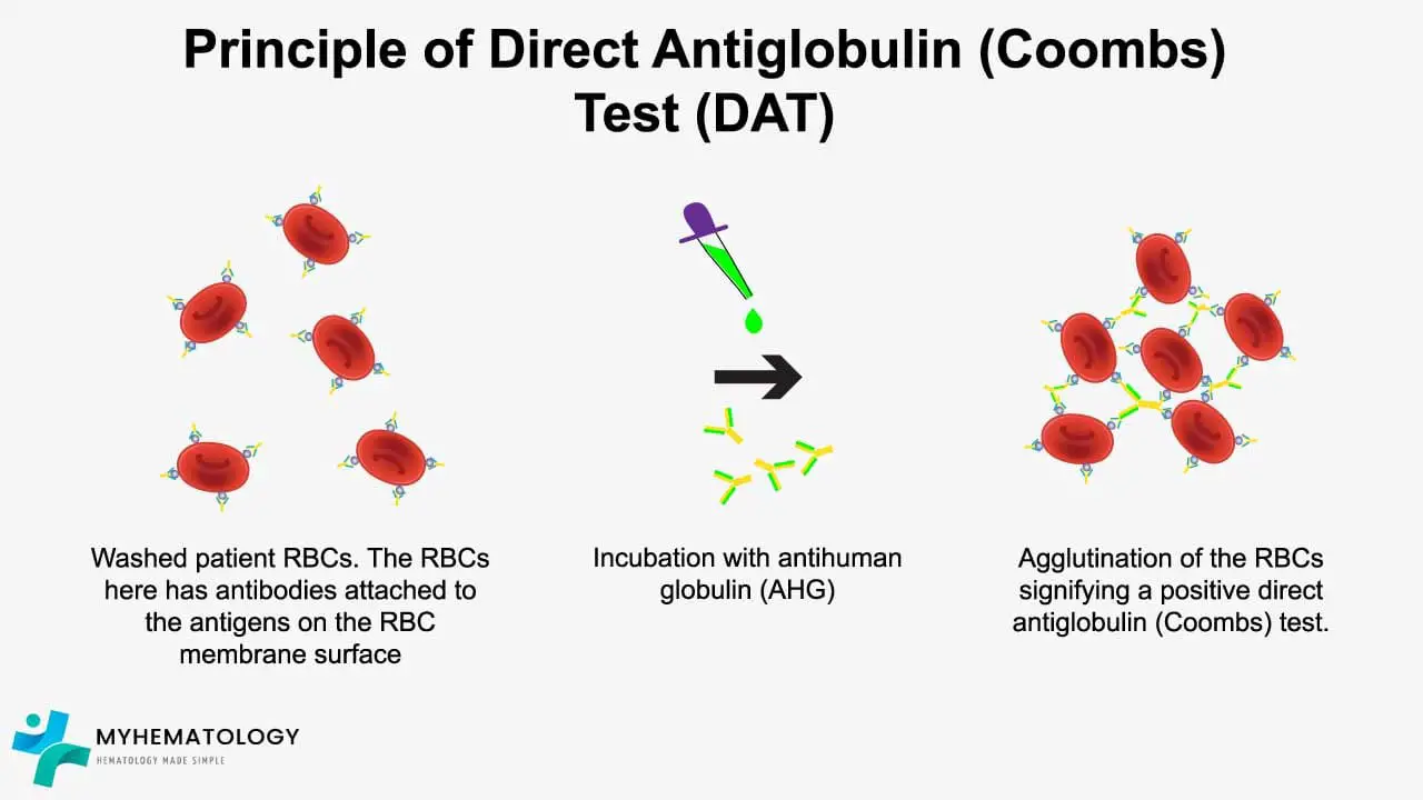 Direct Antiglobulin (Coombs) Test or DAT: Principle & Procedure