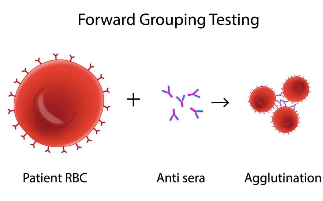 ABO RhD Blood Grouping Tube Method