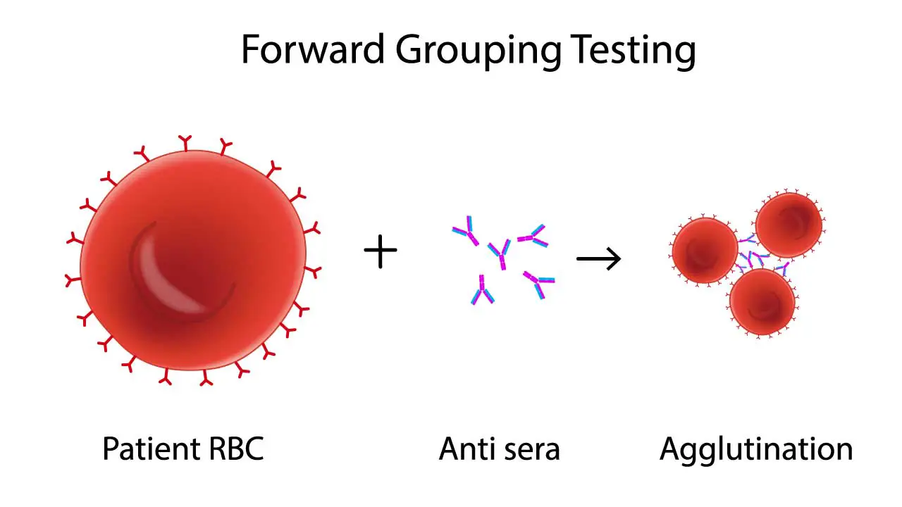 Image illustrating the principle of forward blood group testing, highlighting antigen-antibody interactions