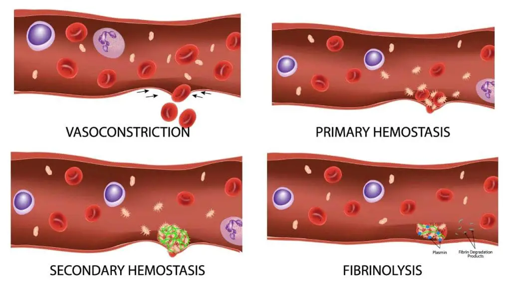 The 4 key processes involved in hemostasis are vasoconstriction, primary hemostasis, secondary hemostasis and fibrinolysis.