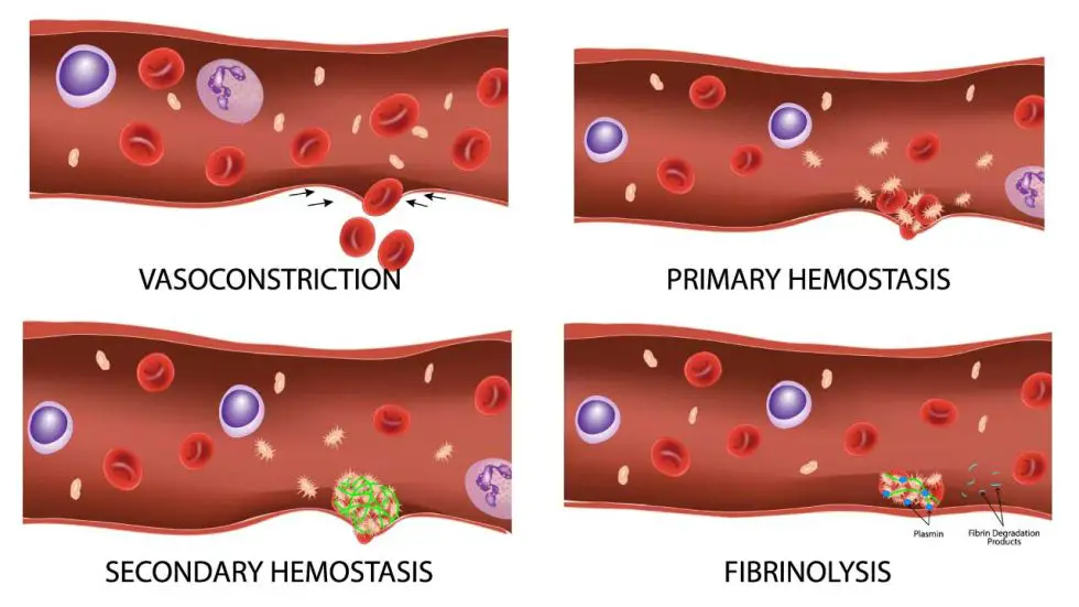 hemostasis-physiology-stages-key-players-disorders