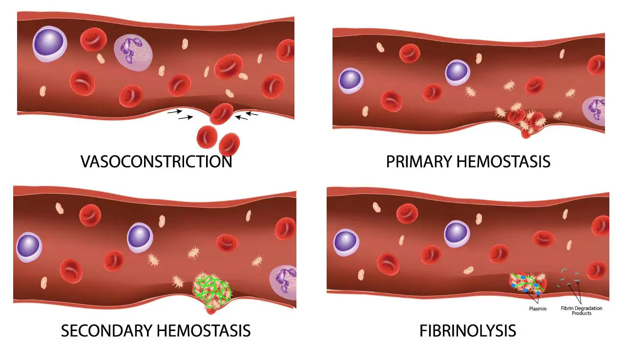The 4 key processes involved in hemostasis are vasoconstriction, primary hemostasis, secondary hemostasis and fibrinolysis. 