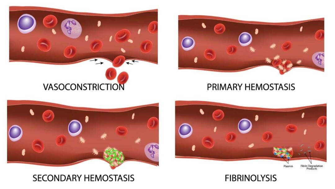 Platelet Function Disorders Causes Symptoms Diagnosis Platelet function disorders causes symptoms diagnosis