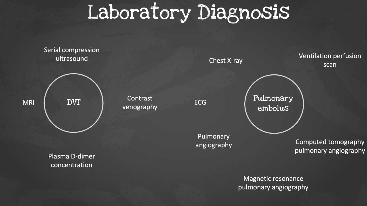 Laboratory diagnosis of VTE using different tools 