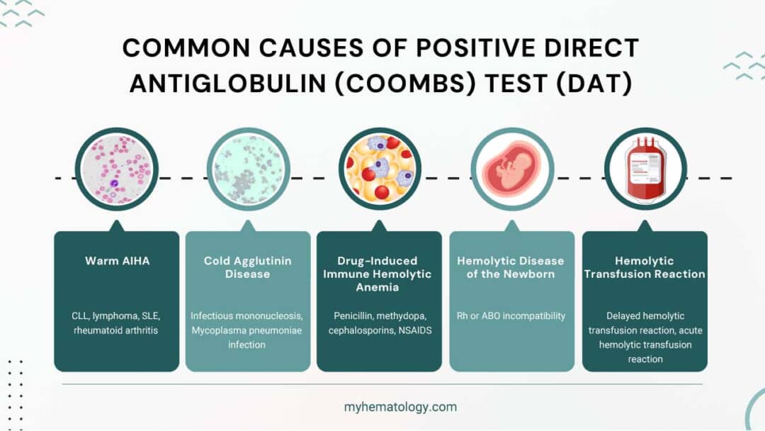 Direct Antiglobulin (Coombs) Test or DAT: Principle & Procedure