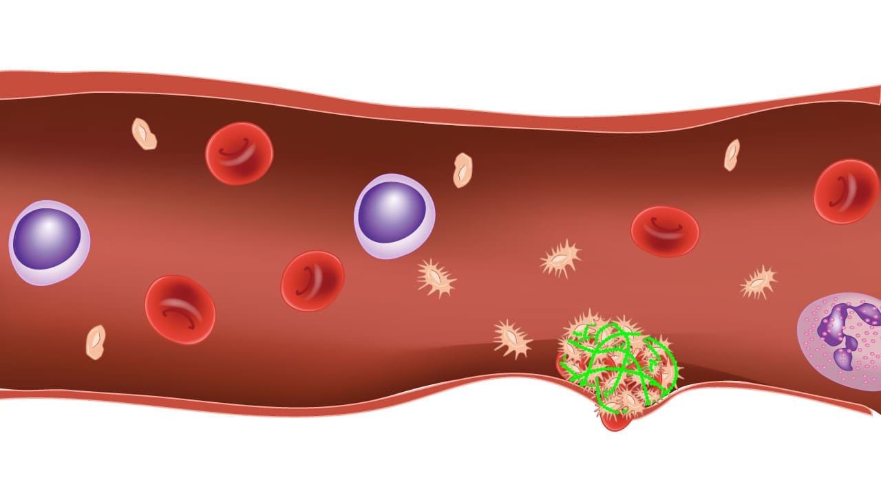 Coagulation cascade activated in secondary hemostasis, creating a mesh of fibrin to strengthen the wound seal.