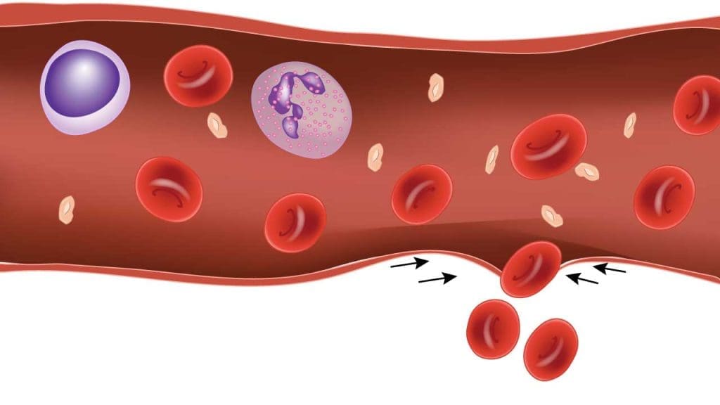 Vasoconstriction, an early stage of hemostasis, reduces blood flow to heal a wound