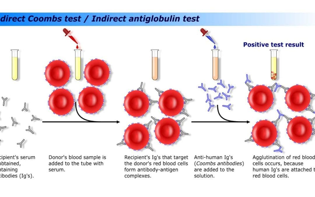 Indirect Antiglobulin (Coombs) Test (IAT)