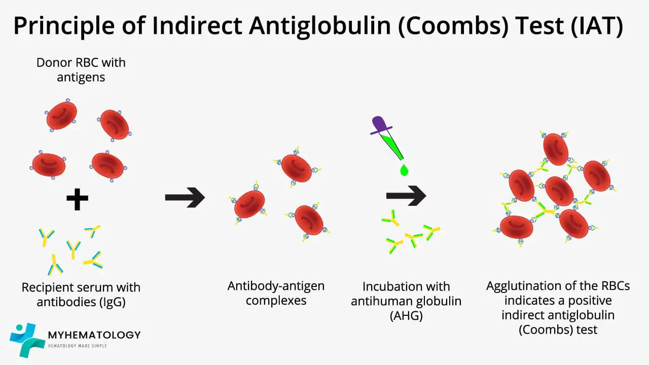 Principle of the Indirect Coombs test (IAT) explained in a schematic diagram
