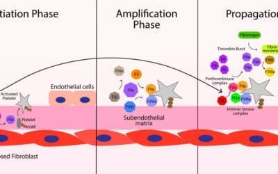 Secondary Hemostasis: Coagulation Cascade