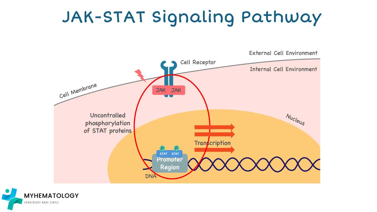The pathogenesis of PV primarily stems from a somatic mutation, most commonly the JAK2 V617F mutation (found in ~95% of cases) or, less frequently, JAK2 exon 12 mutations. These mutations lead to the constitutive activation of the JAK2 tyrosine kinase, a protein crucial for signaling pathways involved in blood cell production. This constant activation bypasses the normal regulatory mechanisms that control hematopoietic stem cell proliferation, particularly in response to erythropoietin. As a result, the bone marrow produces an uncontrolled excess of red blood cells, and often white blood cells and platelets, leading to increased blood viscosity and an elevated risk of thrombotic events.