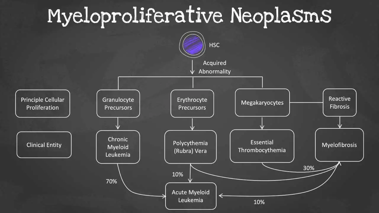 A schematic diagram showing Myeloproliferative Neoplasms (MPNs) and their subtypes. The diagram branches out from MPNs to Essential Thrombocythemia (ET), Polycythemia Vera (PV), and Primary Myelofibrosis (PMF). An arrow from PMF points to Acute Myeloid Leukemia (AML) signifying its potential transformation. Text within the diagram clarifies the defining characteristic of each subtype.