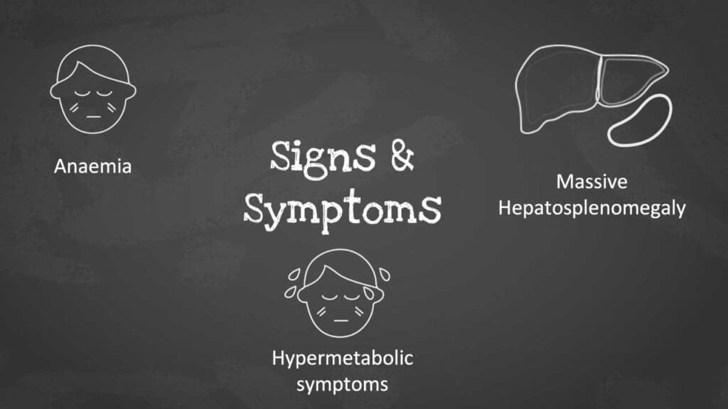 A schematic diagram displaying three key signs and symptoms of primary myelofibrosis (PMF): anemia, massive hepatosplenomegaly, and hypermetabolism. 