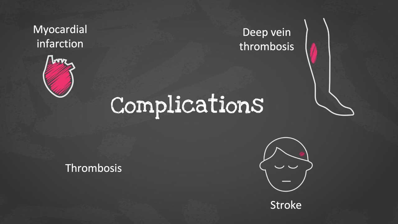 
A schematic diagram depicting potential complications of polycythemia vera (PV). The diagram shows arrows connecting a central element labeled "Complications" to several surrounding elements representing complications: "Deep Vein Thrombosis (DVT)," "Thrombosis," "Stroke," and "Myocardial Infarction."