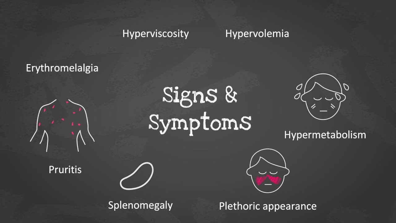 Polyscythemia Rash Polycythemia Vera (PV): Causes, Symptoms & Diagnosis