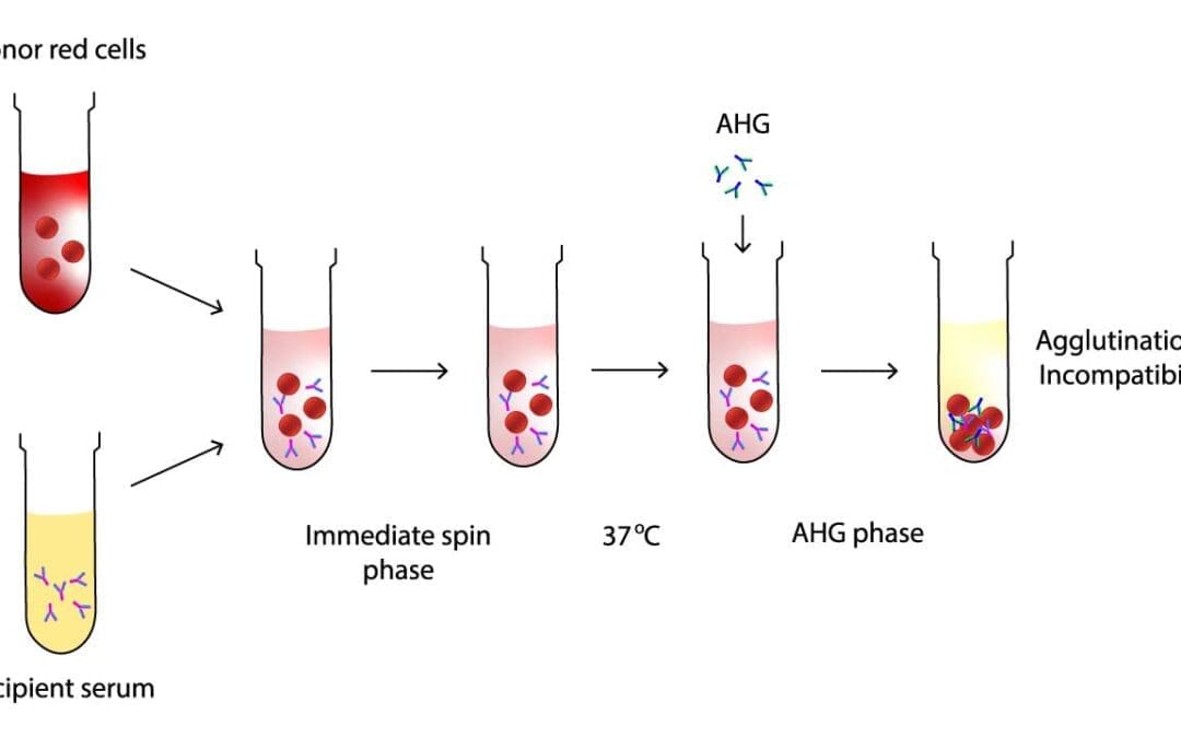 Serologic Crossmatching