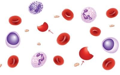 Red Blood Cell (RBC) Morphology