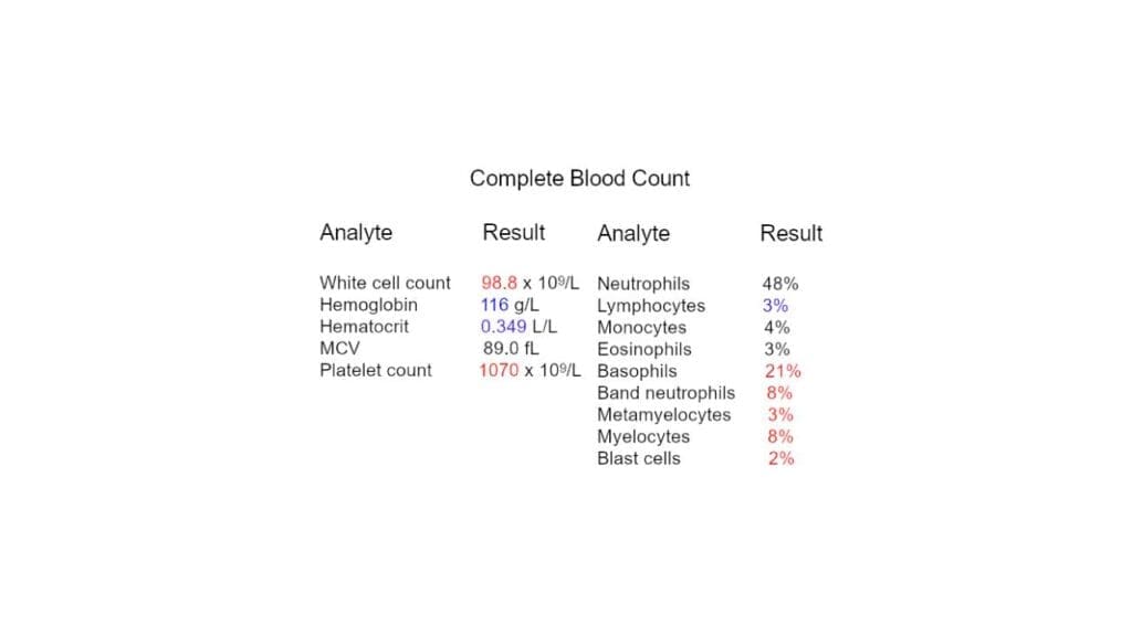 Complete blood count results showing leukocytosis, anemia and thrombocytosis. 